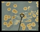 fast growing mycobacterium